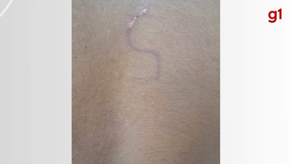 Prima de indígena queimado com marca de gado diz que agressão foi considerada como brincadeira por caseiros: ‘Tratado como animal’